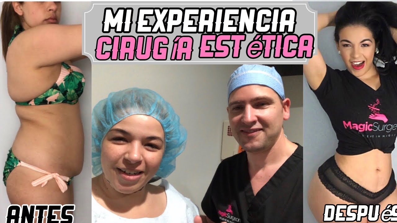 Mi Experiencia con la Cirugia|Lipoescultura|Doctor Humberto Palladino|Nady