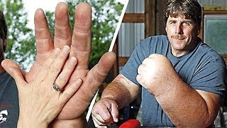 9 PEOPLE WITH THE BIGGEST ARMS, FEET AND MORE. YOU WON’T BELIEVE THEY ARE REAL