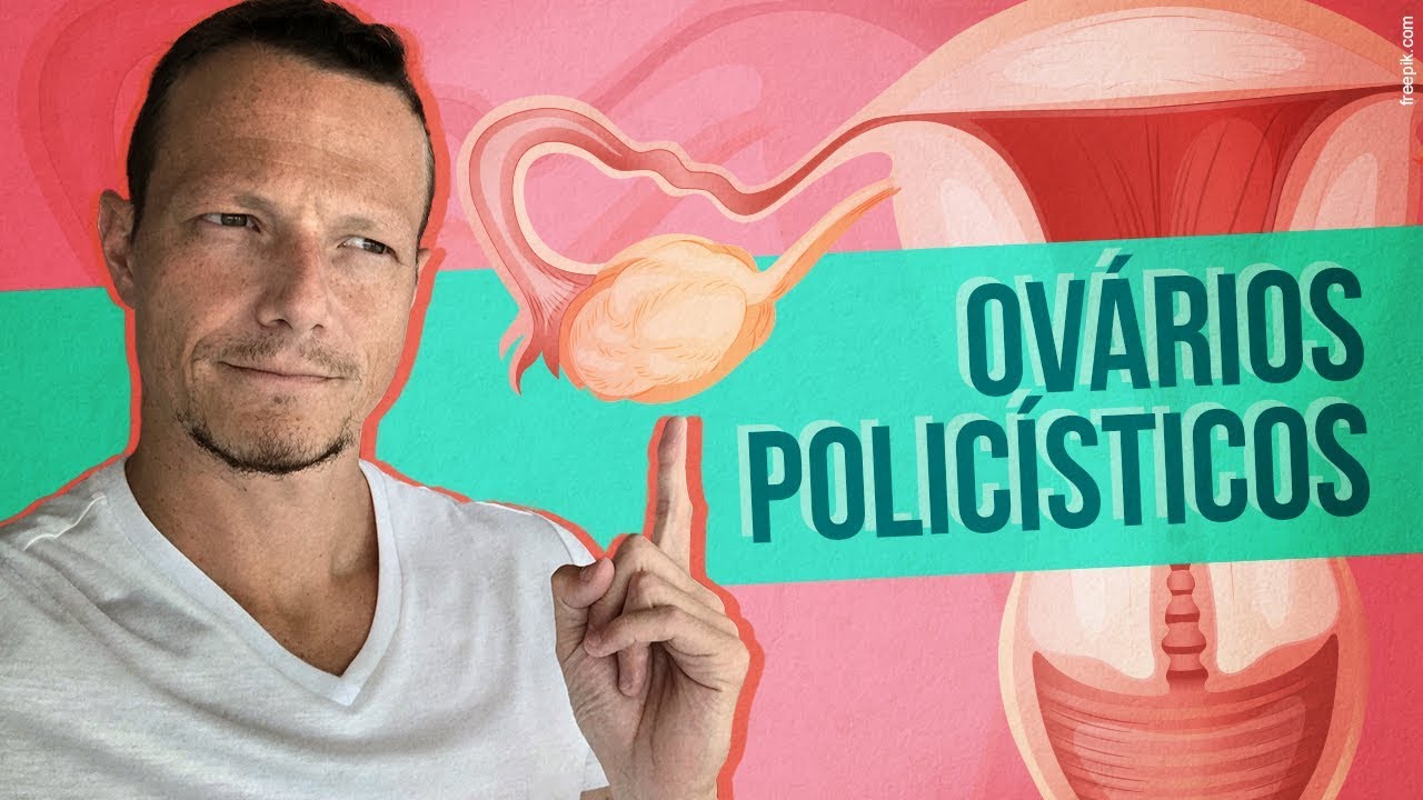 SÍNDROME DO OVÁRIO POLICÍSTICO - Como RESOLVER Com a Alimentação!