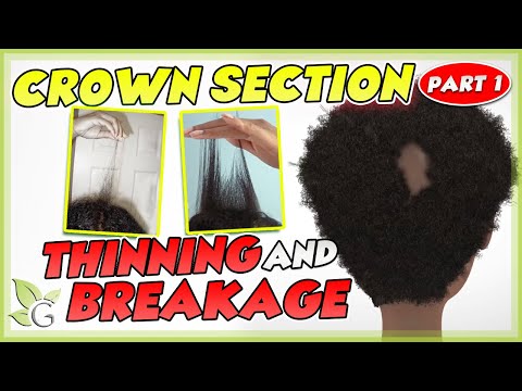CROWN SECTION soreness, thinning & breakage CULPRITS & SOLUTIONS (part 1 of 2)