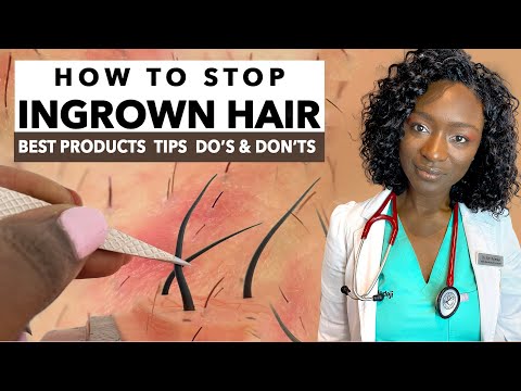 How to Stop Ingrown Hairs & Razor Bumps from Waxing & Shaving | Treatments & Products | Black Skin