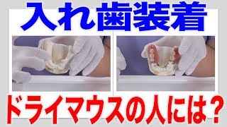 ドライマウスの人の入れ歯装着時には？