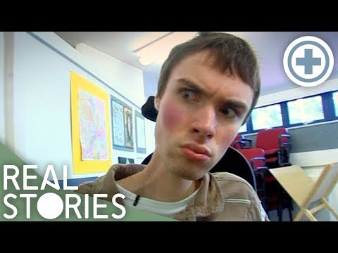 The Boy Who Can Never Grow Old (Medical Documentary) | Real Stories