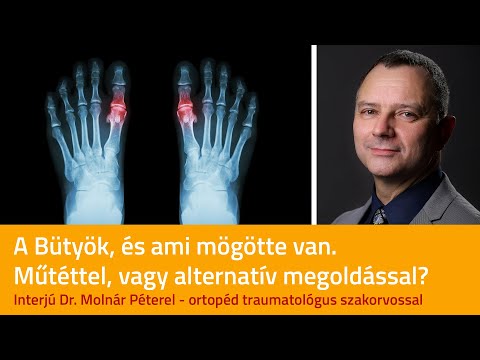 Artróziskezelés a tibeti orvoslásban