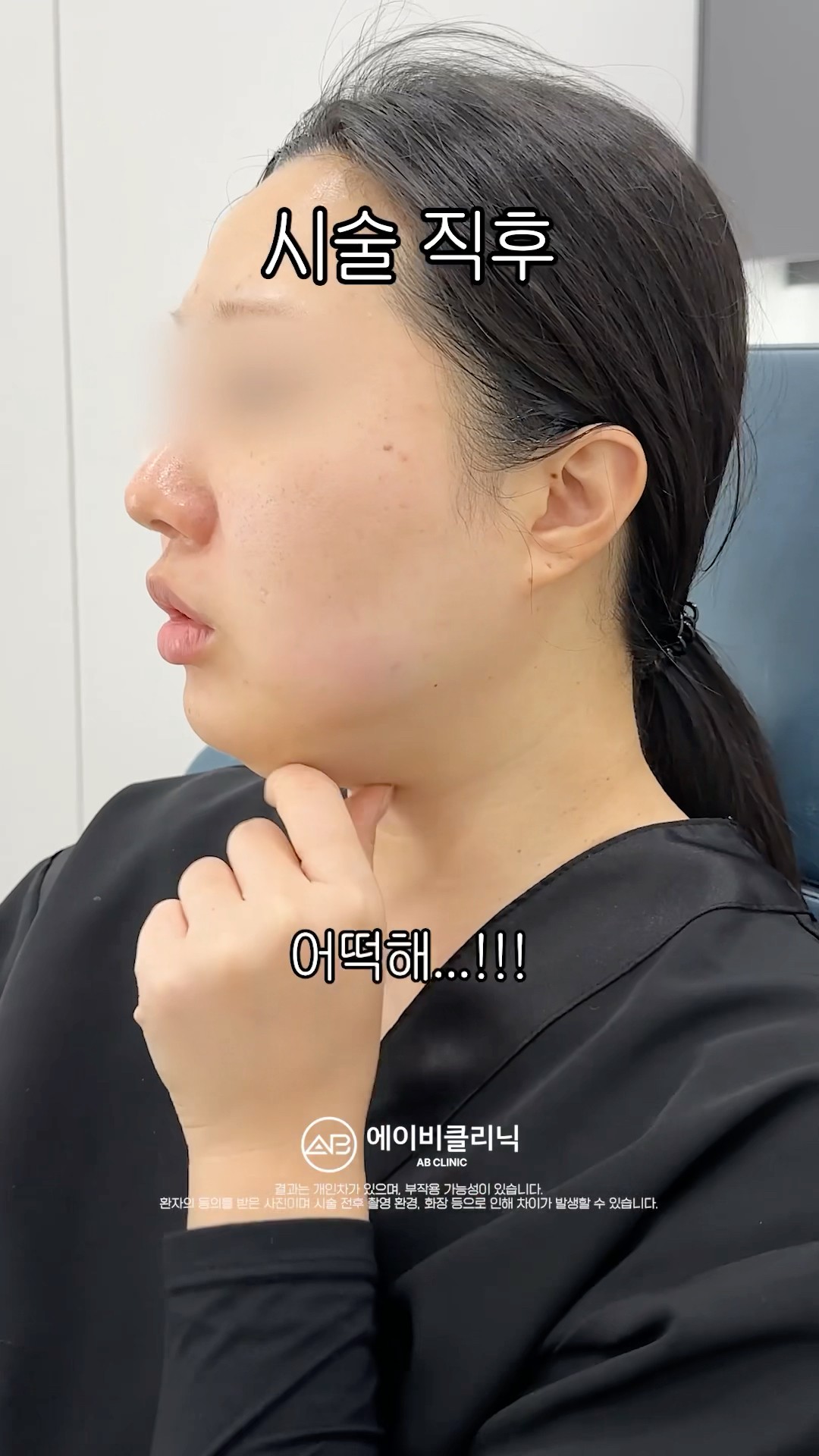 턱살 있었는데? 없어졌습니다💯