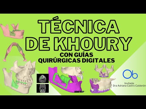 TÉCNICA DE KHOURY