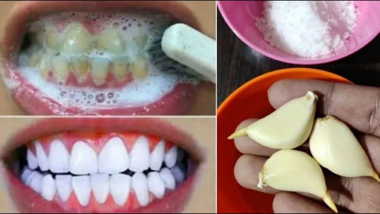 تبييض الاسنان في المنزل في 2 دقائق || كيف تبيض أسنانك الصفراء طبيعيا || 100٪ فعال