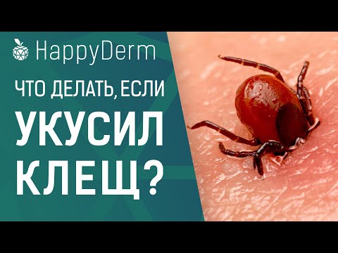 Как достать клеща самостоятельно, лучшее средство против клещей, про энцефалит и боррелиоз