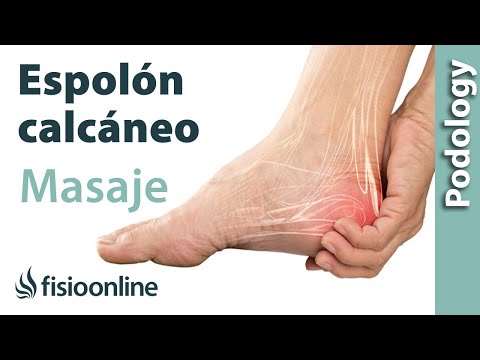 Aprende a hacer un masaje para aliviar el dolor por espolón calcáneo