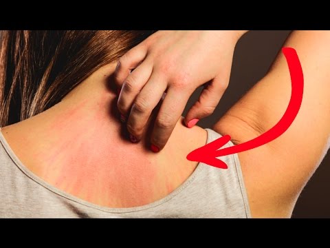 Video Deformierung des Knies Rückenschmerzen während der Schwangerschaft 34