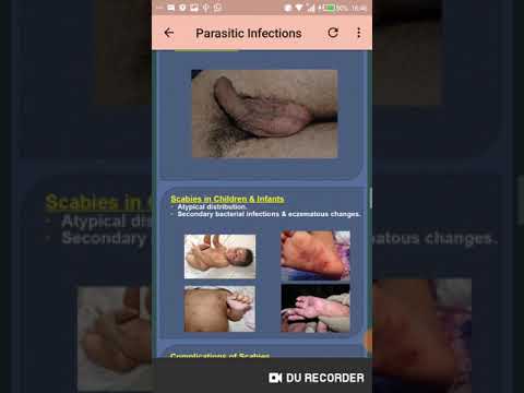 All Skin Infections & Treatments Video