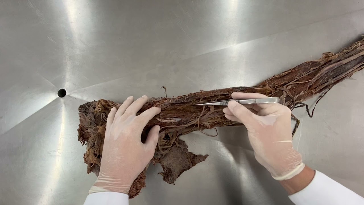 Músculos do Membro Superior - Aula Prática