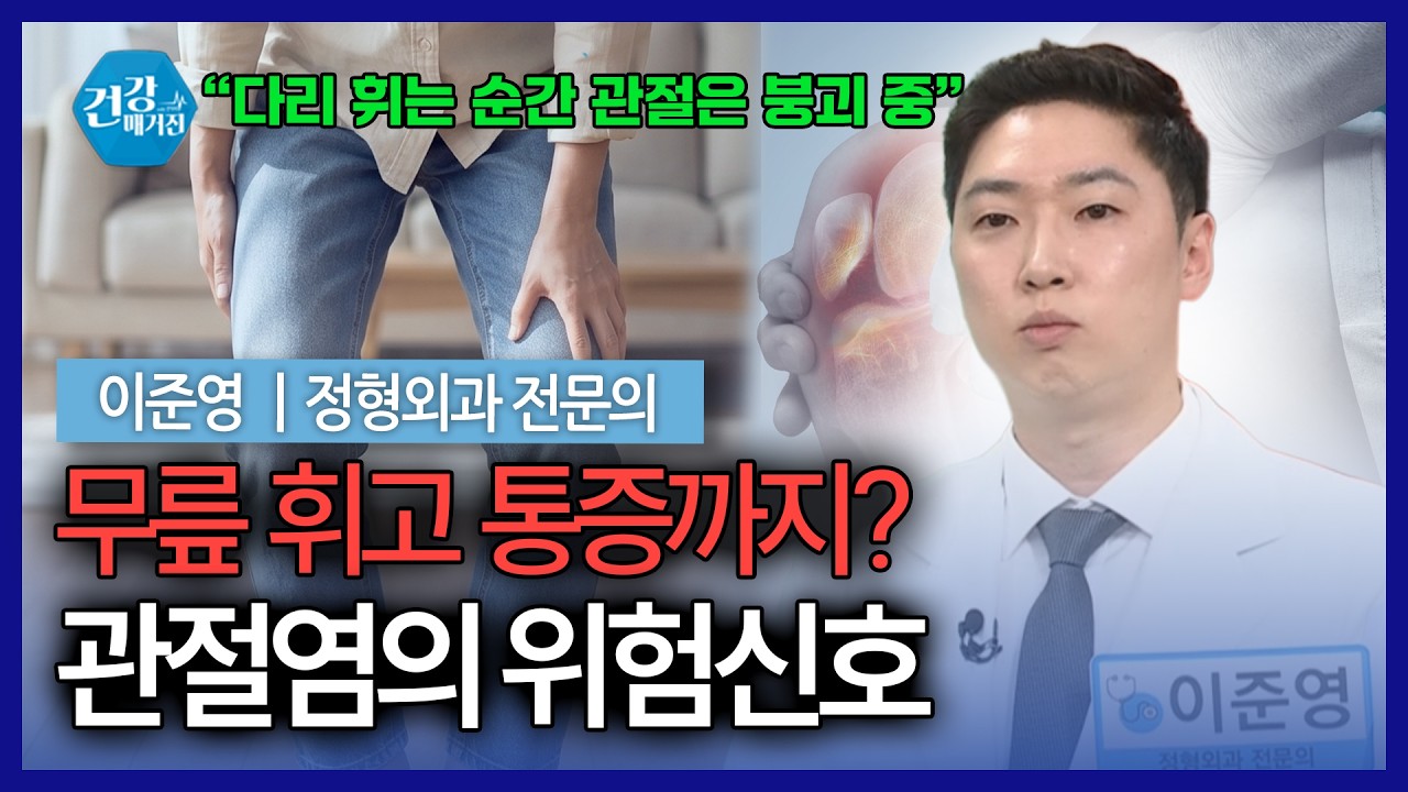 무릎 관절염으로 다리까지 휜다? O자다리 교정술 꼭 필요할까 [건강매거진]