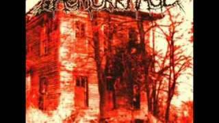 Haemorrhage - Unlock the morgue