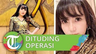 Perubahan Wajah Via Vallen, Dituding Lakukan Operasi Plastik, Sepulang dari Bangkok Naik 4 Kg