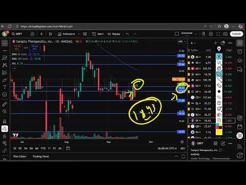 SRPT Stock (Sarepta Therapeutic stock) SRPT STOCK PREDICTION SRPT STOCK analysis SRPT stock news