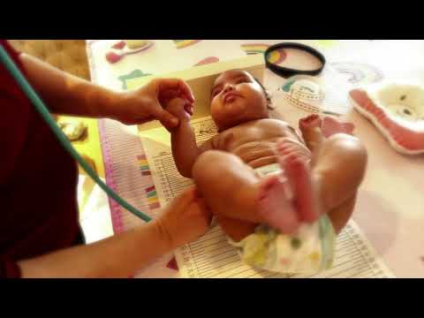 Physical examination of the newborn