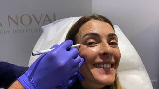 Tratamiento de Bótox. Rejuvenecimiento facial y prevención de arrugas.