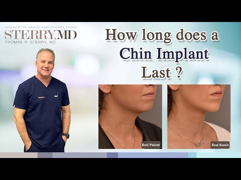How Long Does a Chin Implant Last?