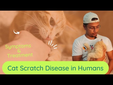 Cat Scratch Disease in Humans| Symptoms & Treatment in Hindi