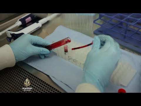 Eritrociti iz laboratorije: Prvo ispitivanje provedeno u V. Britaniji