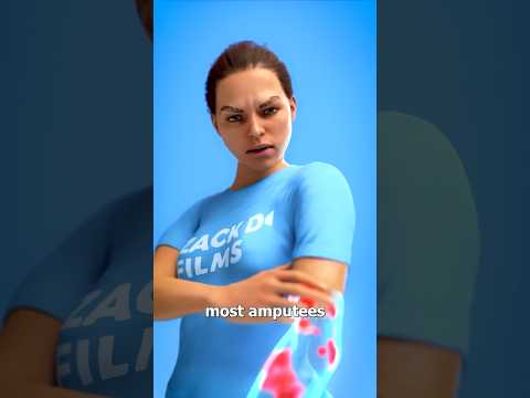 What Is Phantom Limb Pain? 😨 Doctor Reacts