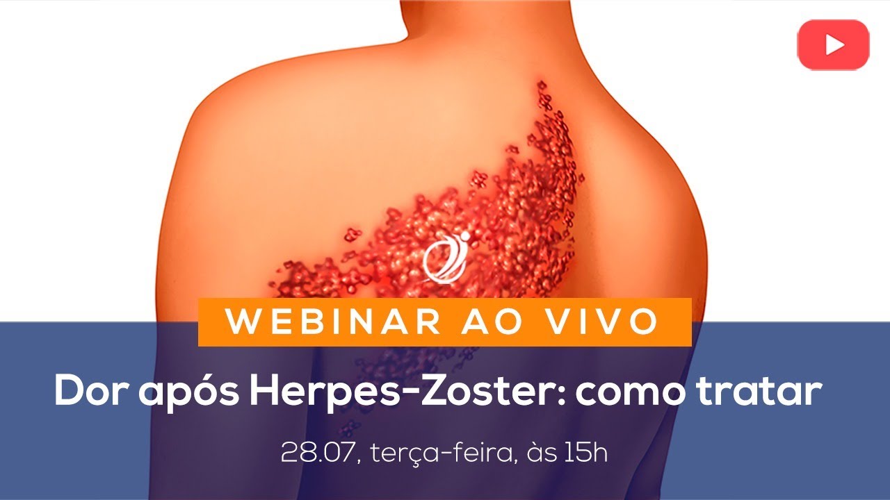 ActMed Ao Vivo: Dor após herpes-zoster: como tratar
