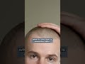 Does Shaving Your Hair Make Your Hair Thicker?