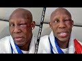 IM SAD BUT AT PEACE - YORDENIS UGAS SHOWS OFF BROKEN ORBITAL; SAYS FIRST WORDS AFTER SPENCE FIGHT