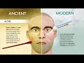 Ancient Vs. Modern Medicine
