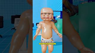 Download lagu People Born With EXTRA Body Parts?! 🤯🧬👀😱 #shorts mp3