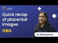 Quick Recap Of Placental Images By Dr Ramyashree OBG DBMCI EGurukul