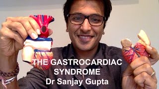 The gastrocardiac syndrome - heart palpitations caused by the stomach