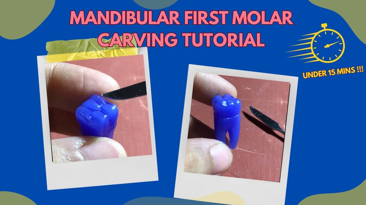 MANDIBULAR FIRST MOLAR CARVING TUTORIAL ! #MANDIBULARMOLARCARVING #dentalstudents #dentaleducation