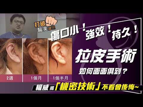 拉皮手術的代價是傷口大? 拉皮傷口大小取決於這項關鍵技術! 不想花冤枉錢一定要看...
