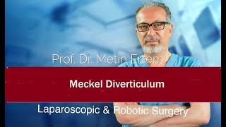 Miniaturka - Meckel diverticulum. Metin Ertem MD FACS.