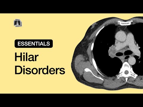 Hilar Disorders | Chest Radiology Essentials