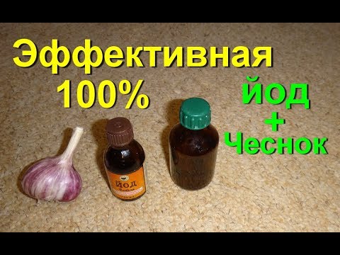 Упражнения для коленного сустава по бубновскому в домашних условиях Мышцы шеи боли симптомы