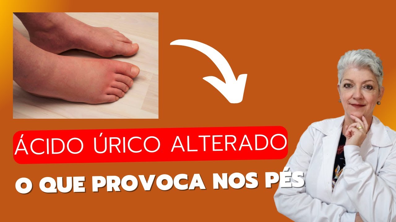 ÁCIDO ÚRICO Alterado O que pode provocar nos PÉS
