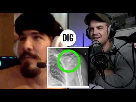 Colt Fake Explains His Mindset and Worst  BMX Injury