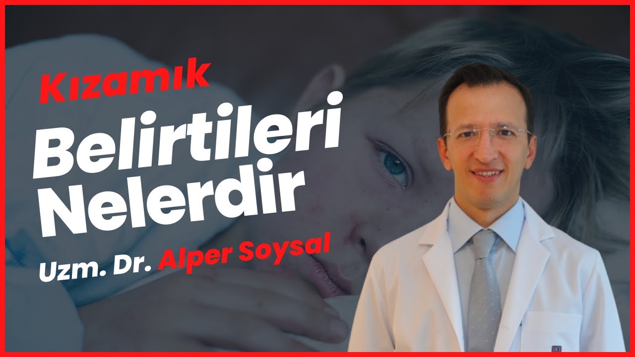 Kızamık Belirtileri Nelerdir? Kızamık Tedavisi Nasıl Yapılır?