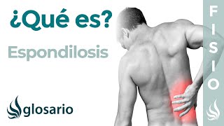 ESPONDILOSIS | Qué es, qué estructuras afecta, síntomas, signos, causas y tratamiento