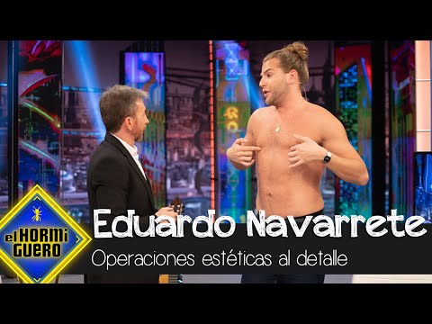 Eduardo Navarrete se quita la camisa para revelar sus operaciones de estética - El Hormiguero