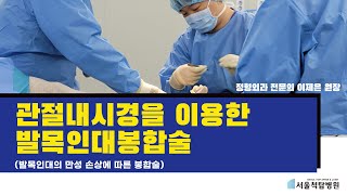 관절내시경을 이용한 발목인대 봉합술