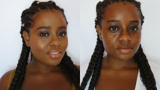 How to Cover Acne Scars Hyperpigmentation and Dark Circles with Colour Correcting | Talk Through