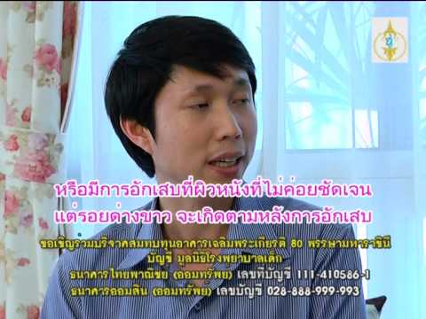 ยาเสพติดกลาก โรคสะเก็ดเงินว่ามันคืออะไรไม่ว่าจะเป็นอันตราย