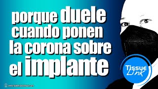 Los IMPLANTES DENTALES si DUELEN, pero NO te lo dicen.