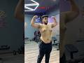 DAY 106 Surgery Chestfat Fatloss Fitness Motivation Yt Shorts Weightloss Viral Ytshorts