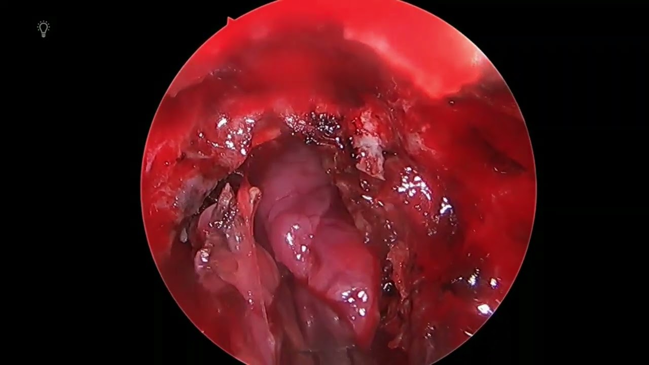 David Tafur Muñoz-2455