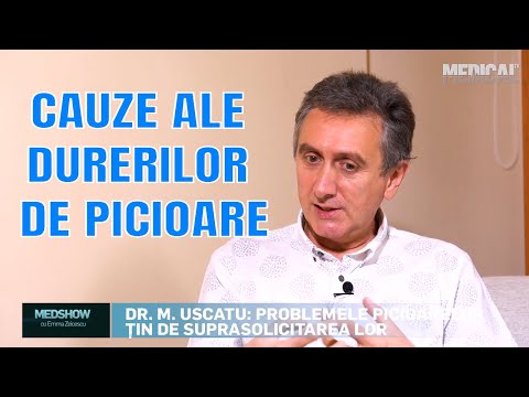 Artroza apelului la genunchi